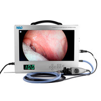 15.6 inch integrated endoscope camera system